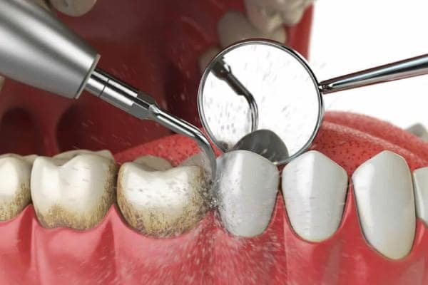 آخرین رتبه قبولی دندان پزشکی زنجان 1400-1401 | فاروس طاها